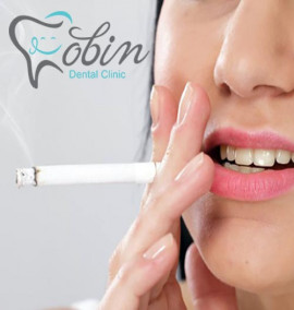 تاثیر سیگار بر کامپوزیت دندان